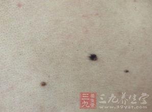 痦子瓜怎么吃,解锁健康美味新选择  第3张